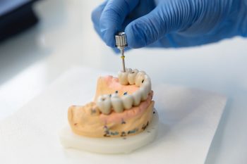 CLINICA DENTAL TORRES